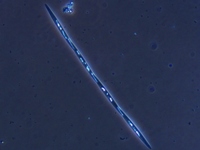 Pseudo-nitzschia sp.